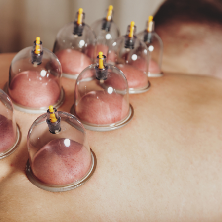 Cupping-Massage